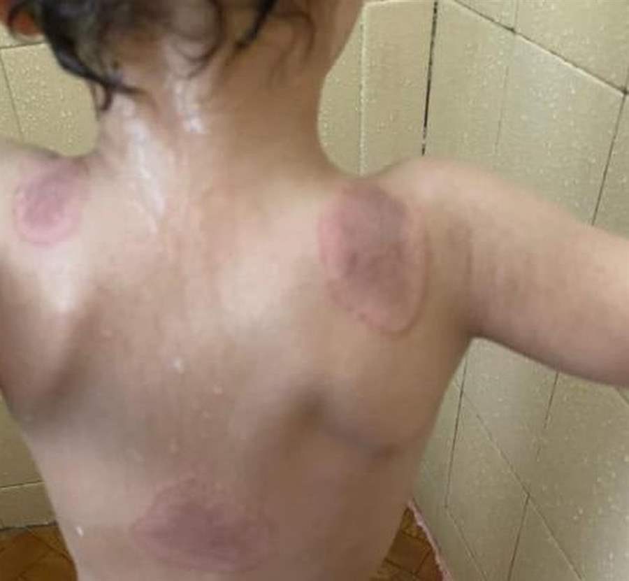 Polícia Civil prende mãe por suspeita de torturar filho de 3 anos