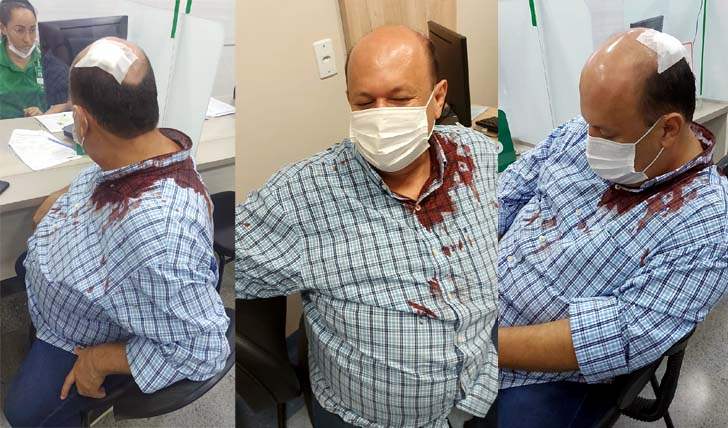 Zezinho do Maria Fumaça é assaltado e leva coronhada de revólver na cabeça
